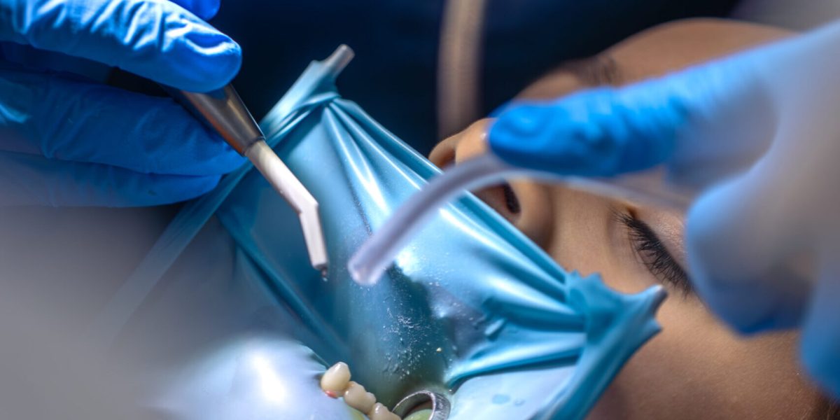 The dentist treats the child's tooth using a rubber dam. Close-up of tooth treatment. High quality photo. Visiting dentist office. Dentistry concept. Installing a rubber dam on the tooth. SSUCv3H4sIAAAAAAAAA41Py47CMAz8F59TKdkWaPMriEMepli0DUoc0KrKv69Sirjubcb2PLwCedBgbX9VQysbb6VvlMJrYwdpGnfqOuzb3h2dBwHeMIJWbdv/HDp57A7DoKSUUoA1iRzoFWiacuJomMICWgqIuHiMG0RPHCKZCbQsAhIbzgkT6LUIcIZxDJE2/vE7r3UOGkBAyraCIv45uwgwIy7ut/qXWmRCs8WdLwLuL8Y479mBb7VihY9IjpZx75QTh/mNl8BVuyVwcHfyu/j9xo0Sh1izID+mYDz6fZ3tTMwfGvFJ+Ppel1L+AGqDHXqEAQAA
